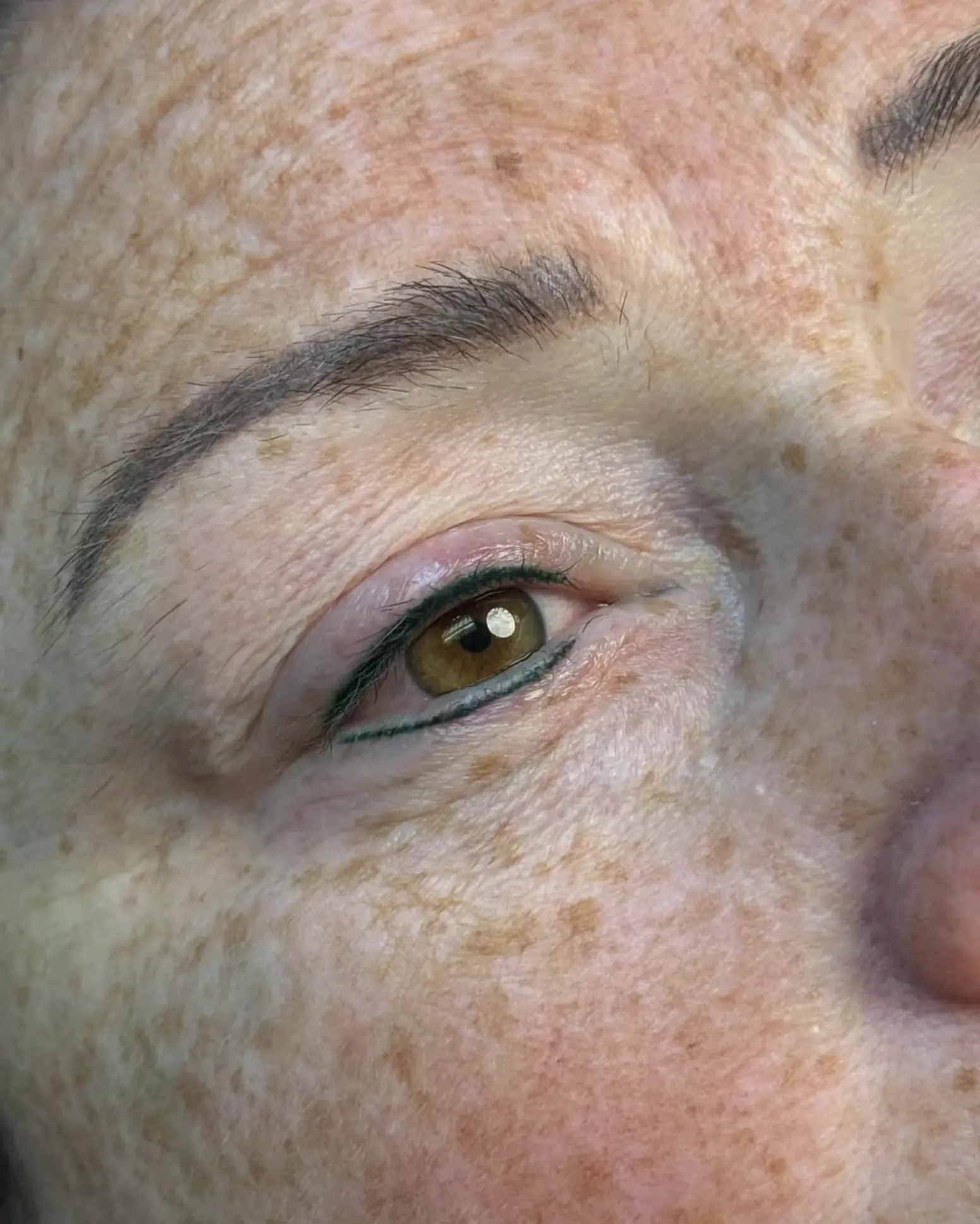 Day 5 eyeliner healing